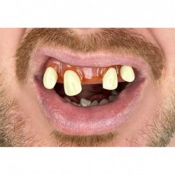 Tiger Teeth Every Smile is Exotic! $17.90 Gags & Practical Joke Toys